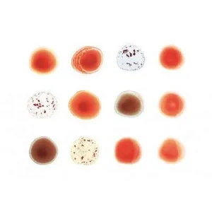 Scratch my back, and I'll scratch yours